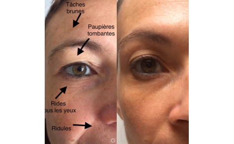 Soins visage haute performance de 16 à 99 ans